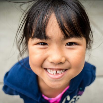 Early Orthodontic Evaluation